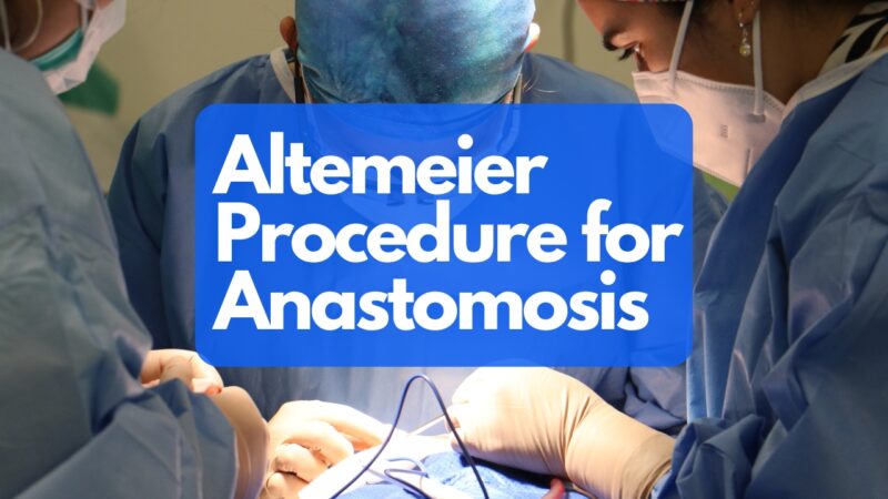 What Is the Altemeier Procedure for Anastomosis? - Key Insights