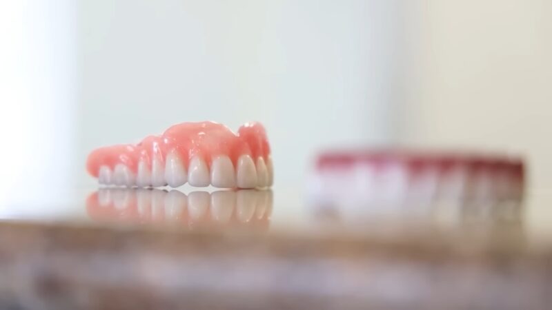 Costs of Dental Implants in the Germany