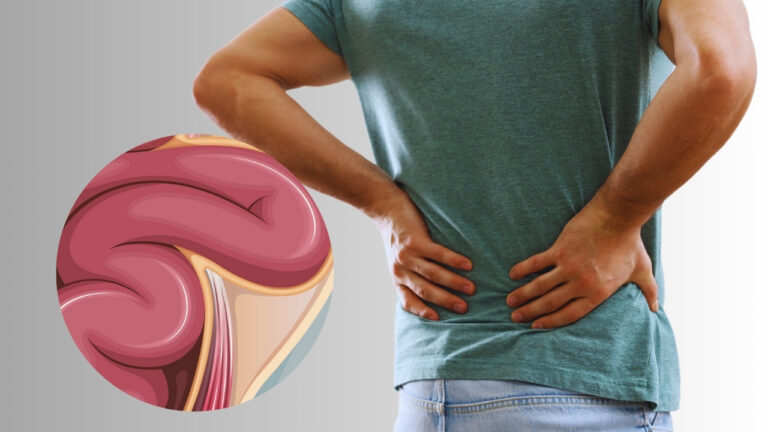 Can Hernias Affect Your Back 9 Key Facts To Know Iaas Med