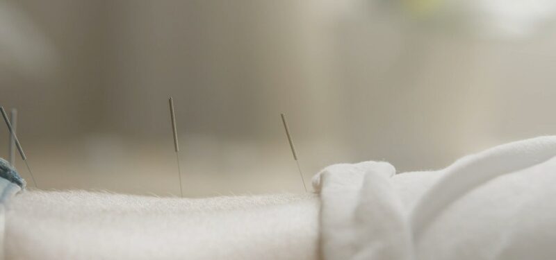 Close-up of acupuncture needles inserted into a patient’s arm during therapy
